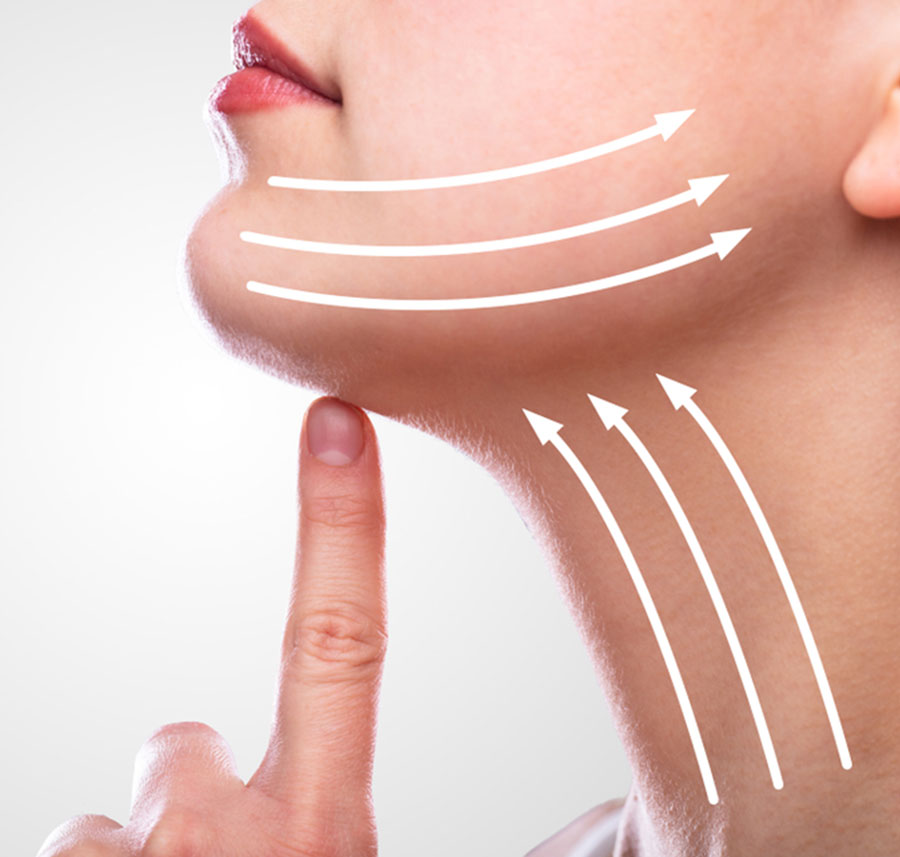 Woman touching her chin with upward arrows showing lifting effect – Chicago Face Remodeling.