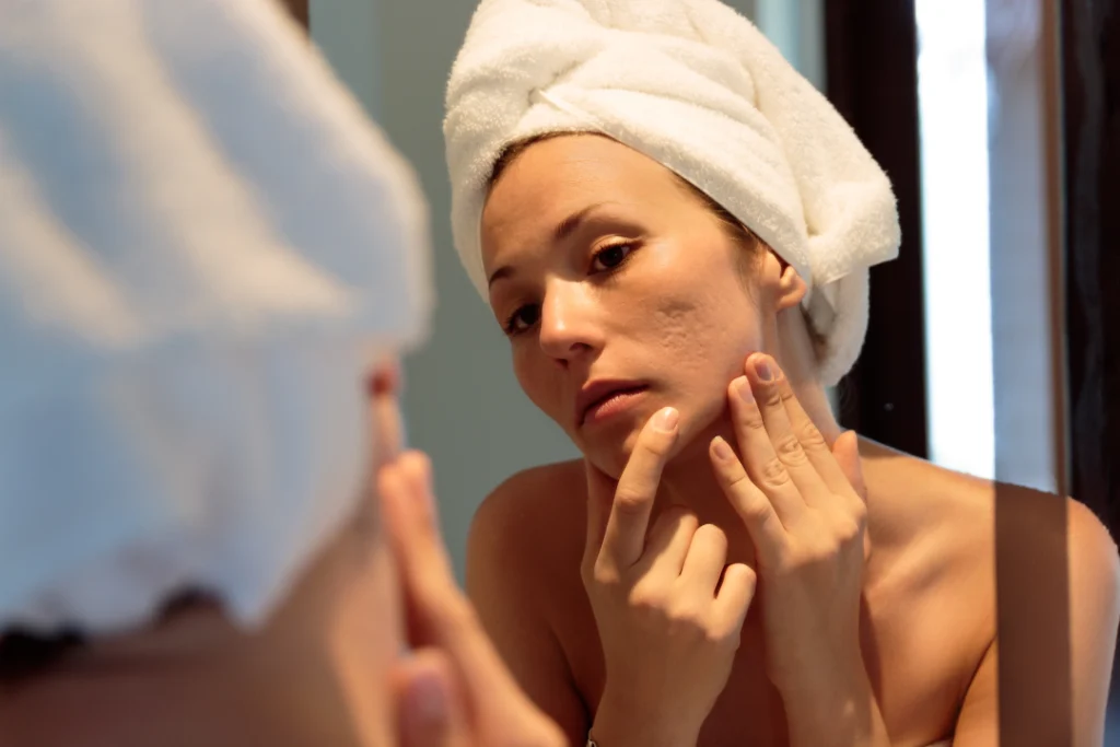 Woman examining facial skin issues needing facials.