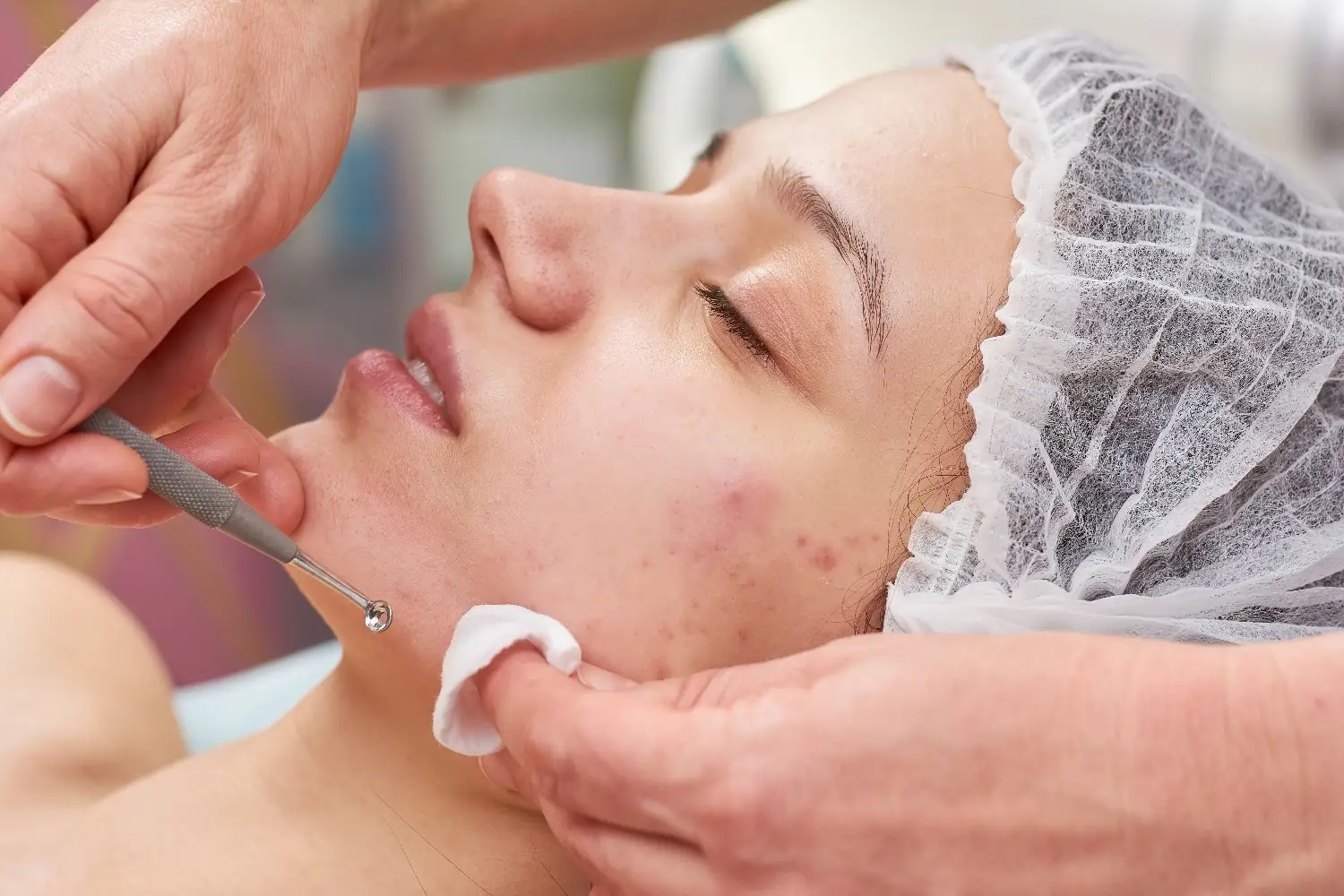 esthetician performing acne extraction on a woman’s face during a facial