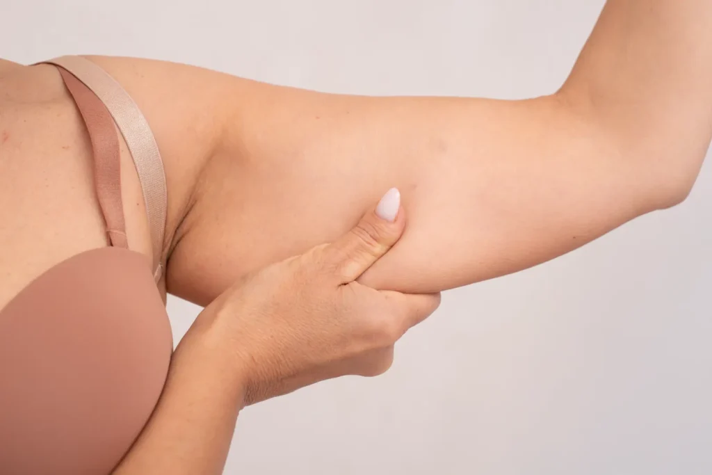 Close-up of hand holding soft skin on upper arm