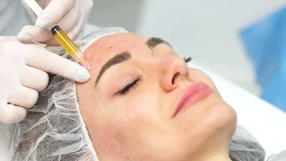 Clinician injecting platelet-rich plasma into a patient’s forehead during a vampire facial.